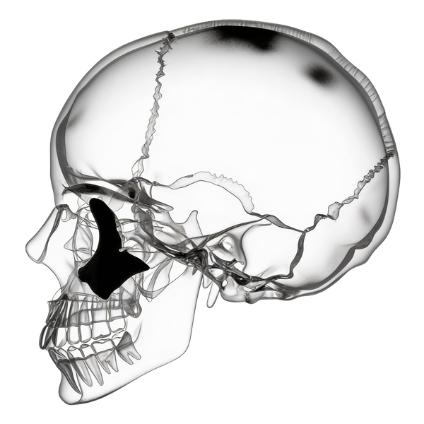 Zygomatic